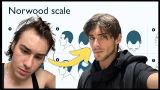 How To Actually Fix Your Hair Loss