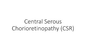 Central Serous Chorioretinopathy (CSR) - For Ophthalmology Residents