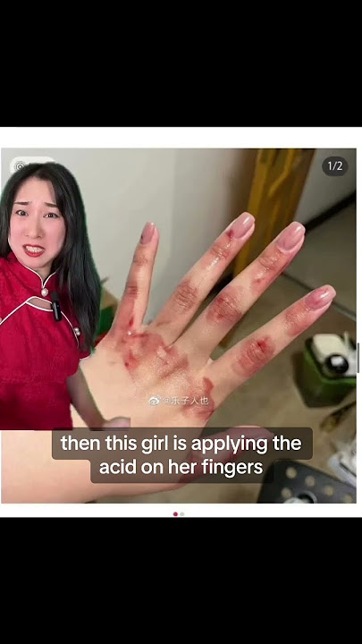 Part 6! I hate to see girls hurting themselves like this #beautystandards #toxic #chinese #mandarin