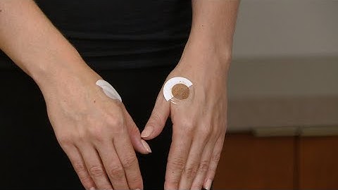 Icewave Part 4 of 4 - Patch Placements - Learn to Patch - GERMAN