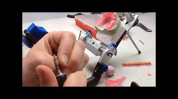 Precision attachment retained overdentures Part - 3