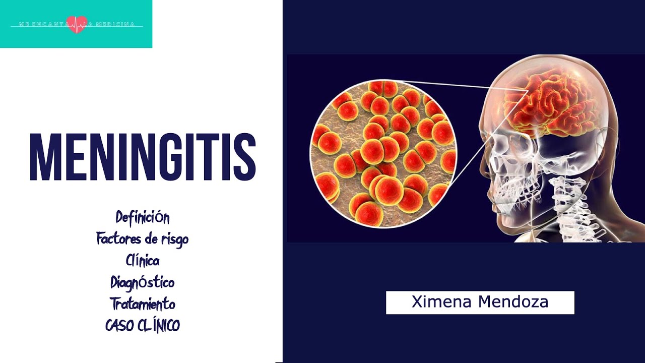MENINGITIS: clínica, diagnóstico, tratamiento, caso clínico ¿Qué nos ...