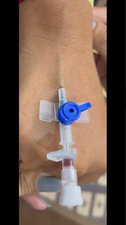 Iv cannula / vigo kaise lagaye | Iv Cannulation