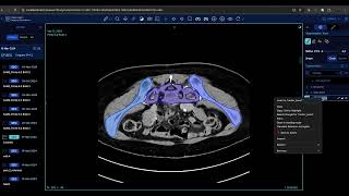 OHIF-SAM2_manual updated Seg