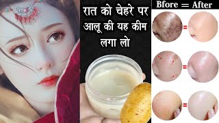 रात को चेहरे पर यह Potato Cream लगालो, झाइयां/दाग धब्बे ख़त्म होकर, चेहरा बेदाग/गोरा होगा|Fair Skin