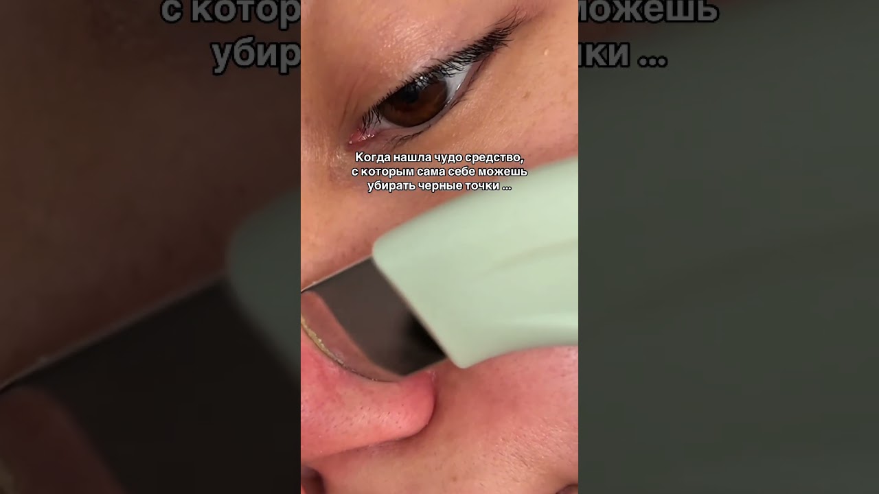 Убираем черные точки без косметолога - ILSO SEBUM SOFTENER 