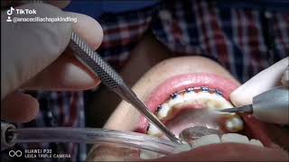 Ana Cecilia Chapa Kindling-48
