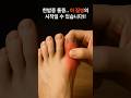 이 질병 시작되면 평생 관리해야 합니다!!