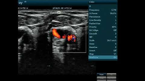 Mindray Z60 deel 3 by EXTRAMEDIC