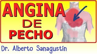 ANGINA DE PECHO  causas, fisiopatología, síntomas, ECG y tratamiento