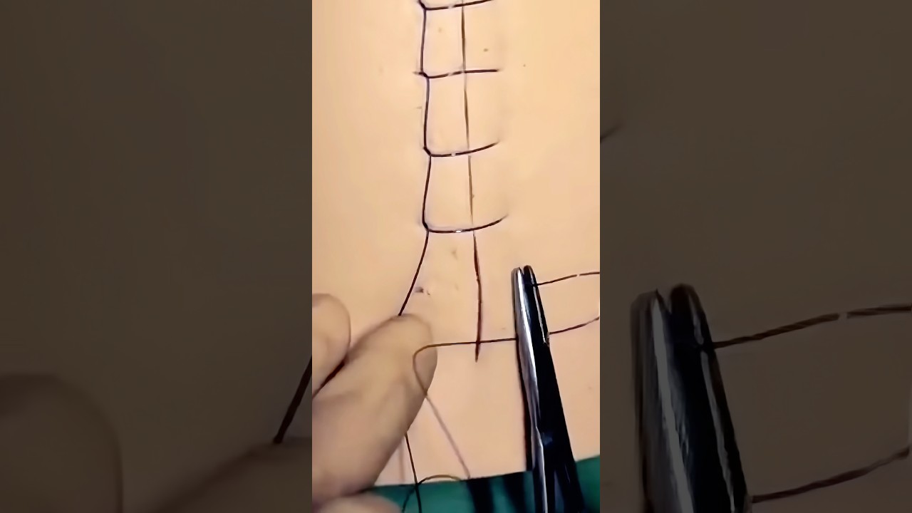 Ford Interlocking Suture 😷#goodtoknow  #suturing #surgeonlife #funfacts #lifehacks #stitches #vet