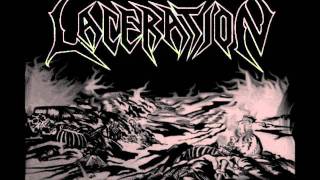 Laceration - Taphephobia