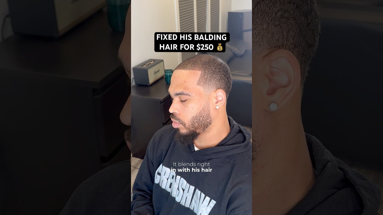 Fixed His Balding Hair For $250 - Taper With Waves 