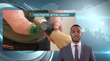 Revolutionary Bionic Arm: The Future of Prosthetics is Here | Real-Life Sci-Fi Breakthrough