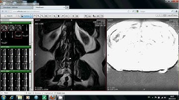 MedDream Flash DICOM Viewer