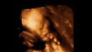 Download lagu Leilee