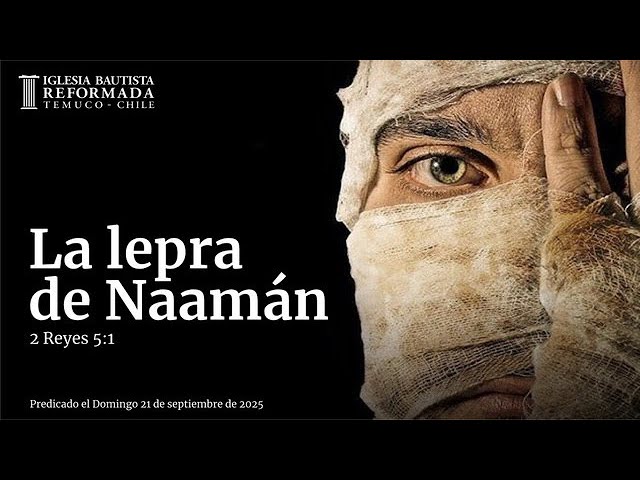La lepra de Naamán (Sermón Evangelístico 21 de Septiembre de 2025)