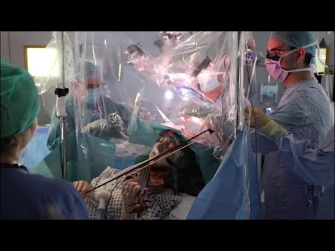 WATCH: Concert violinist plays while undergoing brain surgery in London