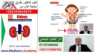 Nephrotic Syndrome    #cme #internal_medicine  #usmle #medical #محاضرات_باطنة screenshot 4