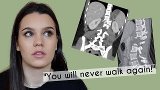 You Will Never Walk Again! The Story Of My Accident