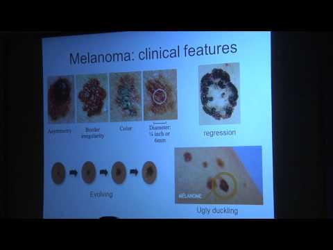 Video: Determination Of The Stage Of Melanoma, Prognosis