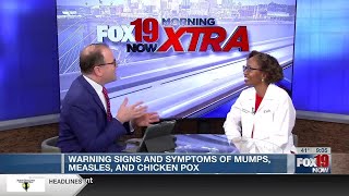 Mumps, measles, Chicken Pox warning signs & symptoms Shannon Westerlund Measles Mumps And Chicken Pox Can Be Life Threatening