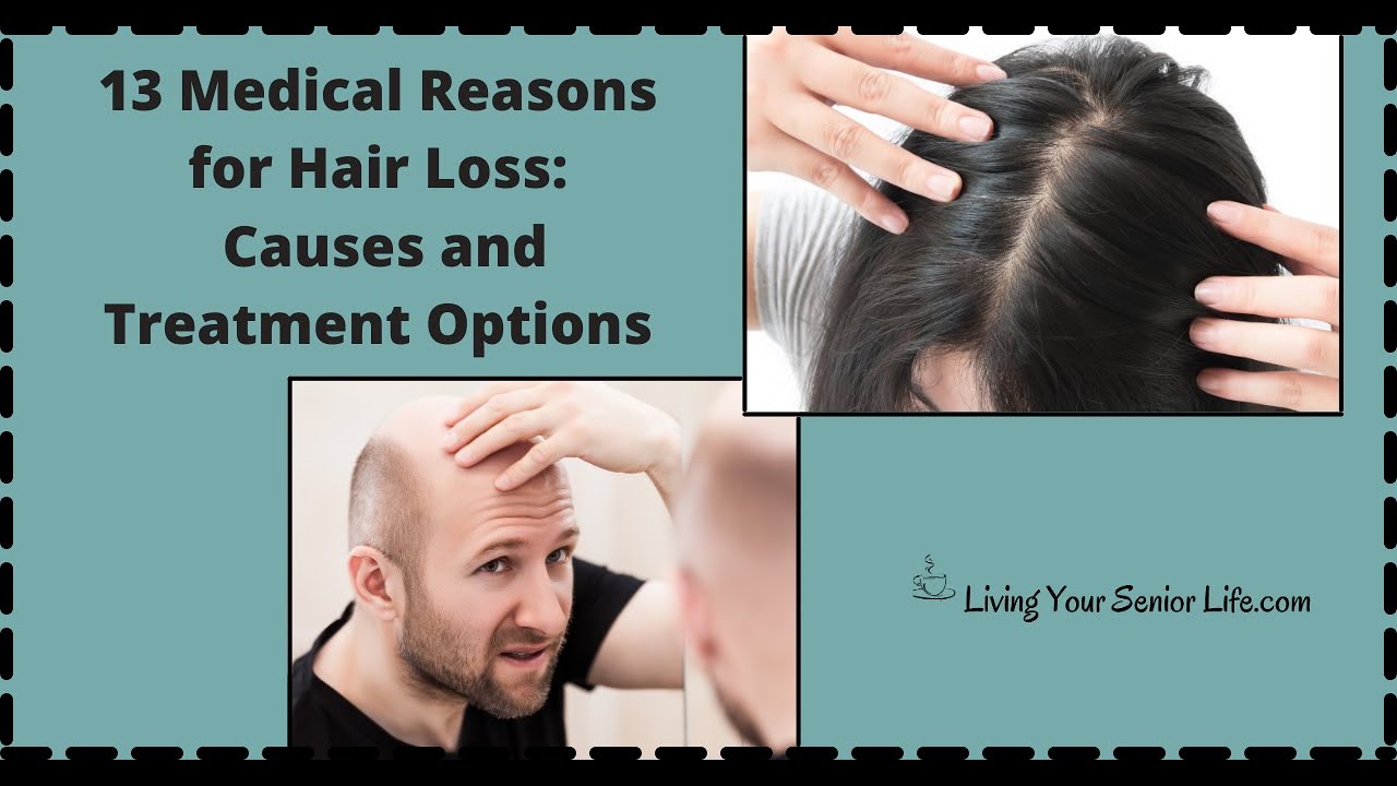 Medical Reasons for Hair Loss Causes and Treatment Options