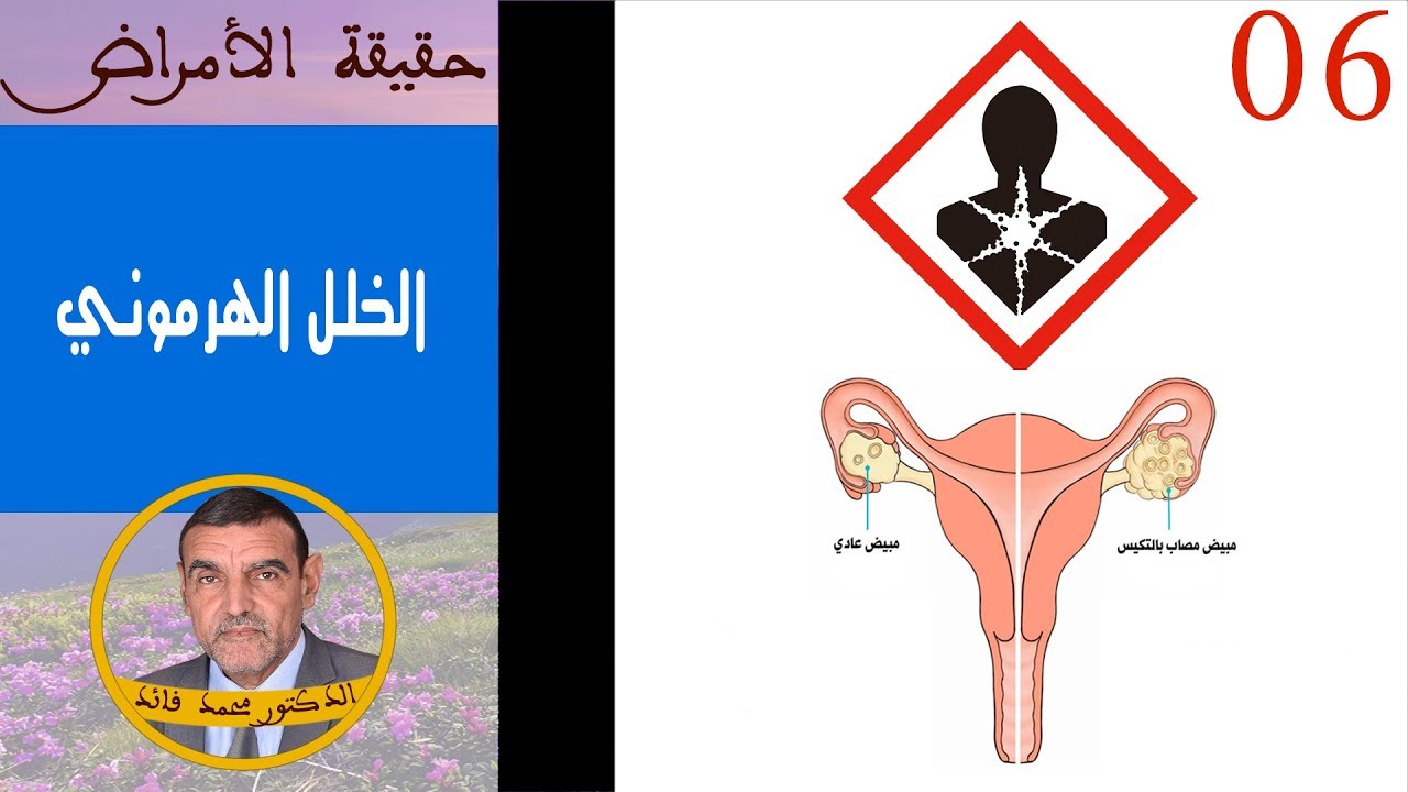 حقيقة الخلل الهرموني | الدكتور محمد فائد