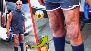 What Happened to RONNIE COLEMAN’s Legs?