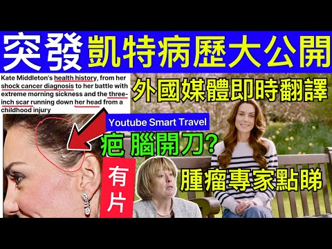 Smart Travel《英國王室秘聞》即時翻譯外媒 凱特王妃 (Kate Middleton) 的健康史，從令人震驚的癌症診斷 ，以及X造成的三英寸長的疤痕 ｜腫瘤專家點講? #凱特王妃自揭患癌