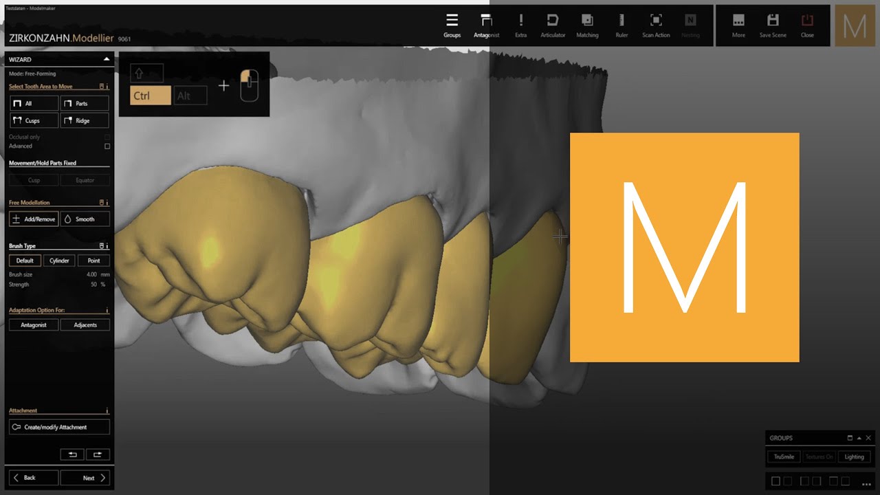 Shortkeys in Zirkonzahn.Modellier | Zirkonzahn.Software