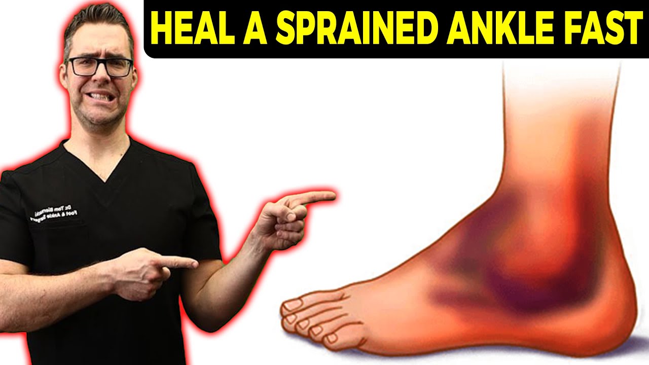 Can You Walk On A Sprained Ankle? [Rolled Ankle Sprain Recovery Time]