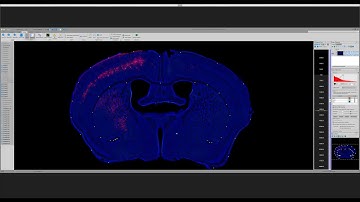 Webinar: Registering Mouse Brain Serial Sections to the Allen Atlas