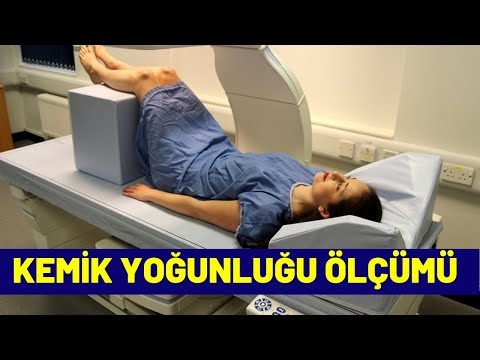 Kemik Yoğunluğu ölçümü nasıl yapılır? Serdar Akgün, Sağlık, Videoları