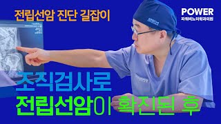 조직검사로 전립선암이 확진된 후