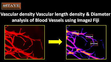 Vascular Density, Vascular Length Density and Diameter analysis of Blood Vessels using ImageJ Fiji