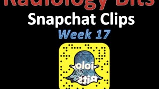 RADIOLOGY BITS (SNAPCHAT WEEK 17) Net Worth