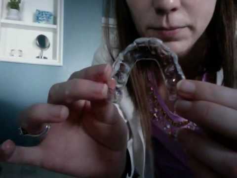 How To Clean lach Direct Club Clear Aligner Trays!