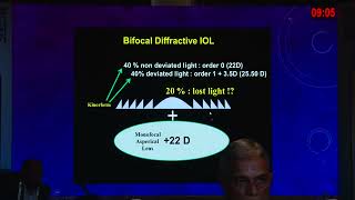 AIOC2026   GP51   T Dr Smriti Sonthalia Current day IOL designs and basic understanding of optics