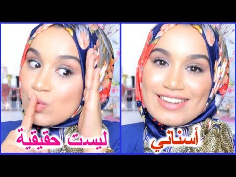 كيف قمت بتركيب أسنان جديدة أسناني كانت كارثية من قبل قصتي الكاملة