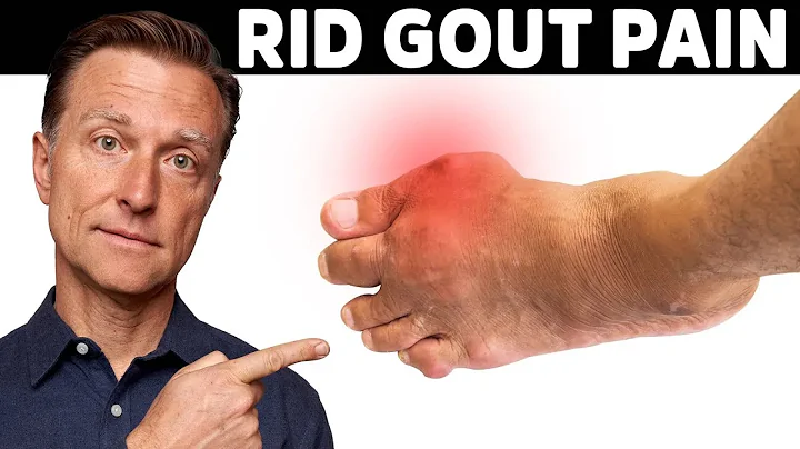 The #1 Best Protocol for Gout - DayDayNews