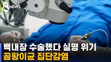 백내장 수술했다 실명 위기…곰팡이균 감염 조사 / SBS