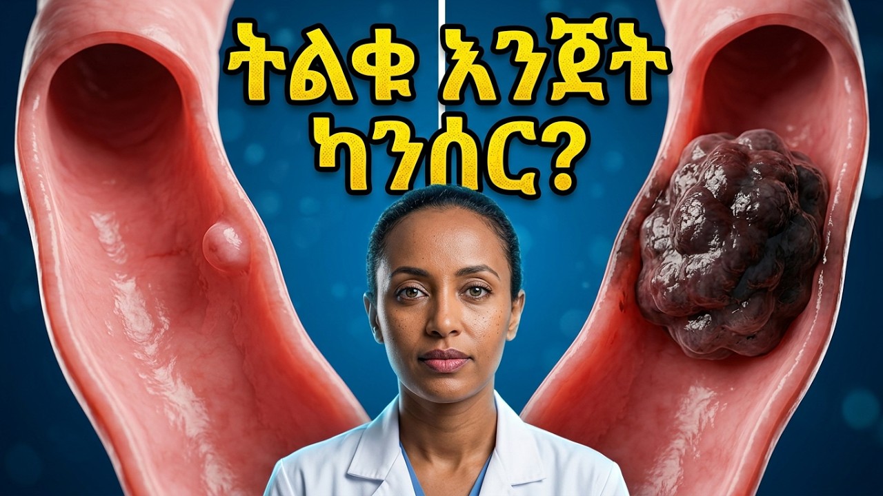 ስለ ትልቁ አንጀት (colorectal) ካንሰር ማወቅ ያለብዎ እውነታዎች