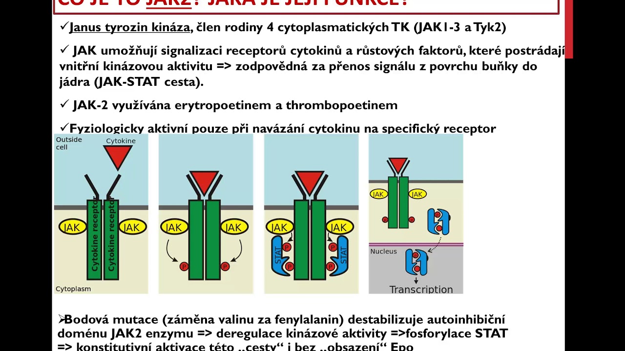 Primární myeloproliferativní onemocnění   novinky v Diagnostice a managementu