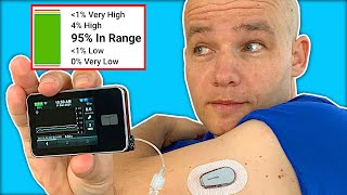 Tandem tslim x2 & Control IQ Changed My Life | Insulin Pump Agorithm Review