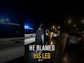 He Blamed His Leg