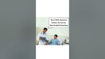 Your X-ray showed a broken rib - Medical Meme  #shorts #memes #medical