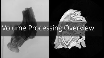 Overview of CT Scan Volume Processing | Introduction to Digital Preparation Video 4