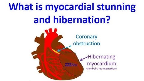 What is myocardial stunning and hibernation?