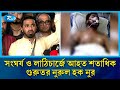 আইসিইউতে নুর, জ্ঞান ফিরলেও শঙ্কা কাটেনি পুরোপুরি | Nurul Haque Nur | Rtv News